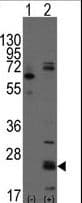 CD9 Antibody (aa21-51)