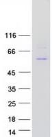 Human POLE2 Protein (Recombinant Myc-DDK (Flag))