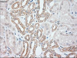 KRT8 / CK8 / Cytokeratin 8 Antibody (clone OTI2E4)