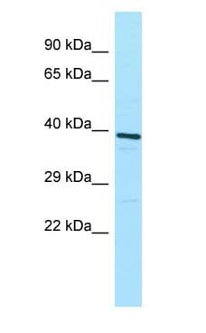 ATP6V0D1 Antibody (aa201-250)
