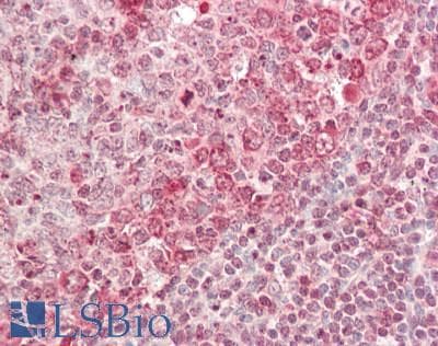 IHC-plus™ EIF4A2 Antibody (aa1-407)