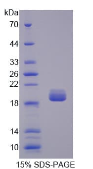 Human TOP3A Protein (Recombinant His)