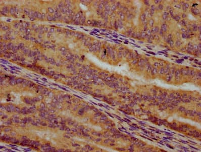 ALG10 / KCR1 Antibody