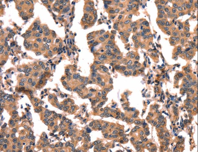 hCG / Chorionic Gonadotropin Antibody