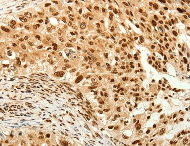 TIGAR Antibody
