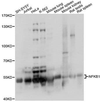 NFKB1 / NF-Kappa-B Antibody