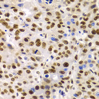 SMARCE1 / BAF57 Antibody