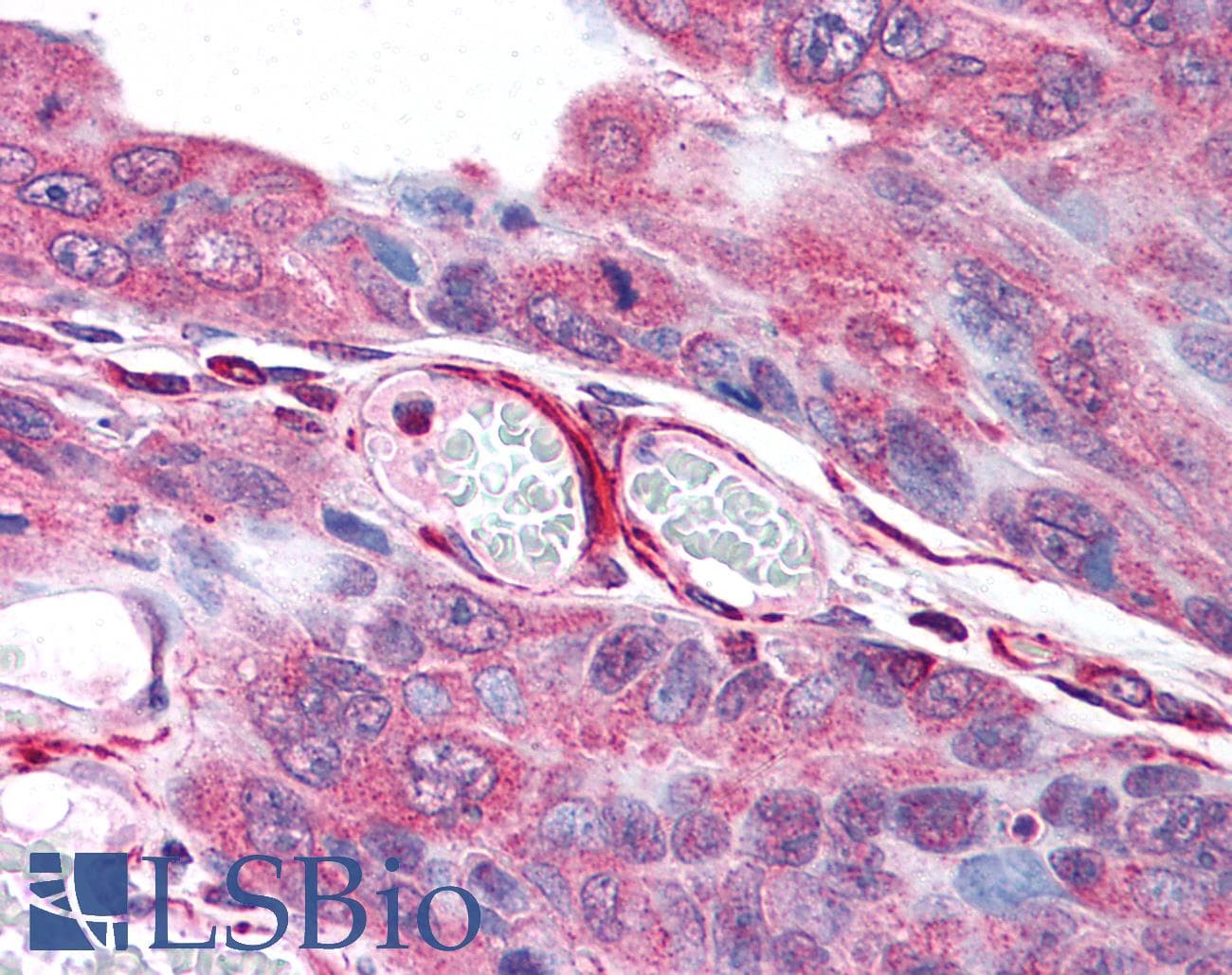 PathPlus™ PLA2G3 Antibody (Internal)