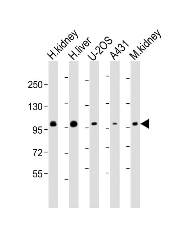 Polyclonal Rabbit anti-Human ACO1 / Aconitase Antibody (Internal, WB)