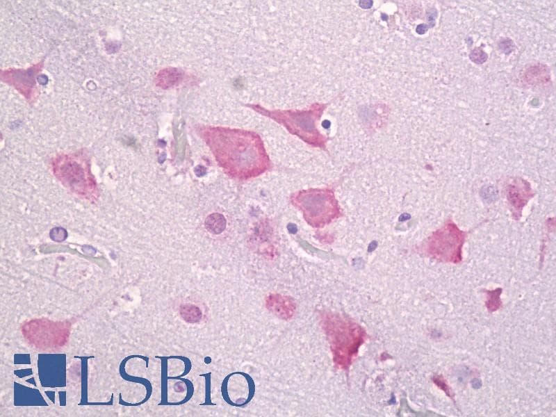 IHC-plus™ Polyclonal Rabbit anti-Human CSNK1E / CK1 Epsilon Antibody (aa276-325, IHC, IF, WB)