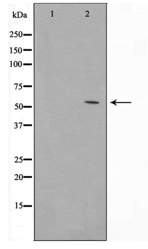 Polyclonal Rabbit anti-Human TP53 / p53 Antibody (IHC, IF, WB)