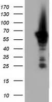 AK5 / Adenylate Kinase 5 Antibody (clone OTI2G4)