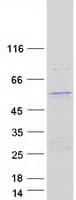 Human VPS13B Protein (Recombinant Myc-DDK (Flag))