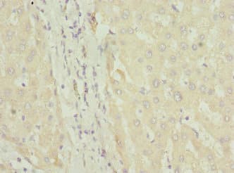 Polyclonal Rabbit anti-Human FASTK / FAST Antibody (IHC)