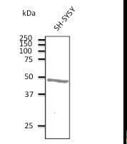 ATXN3 / JOS Antibody (aa120-250)