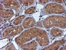 HARS2 Antibody (clone OTI5H2)