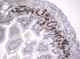 MKI67 / Ki67 Antibody (aa1160-1493, clone OTI15A4)