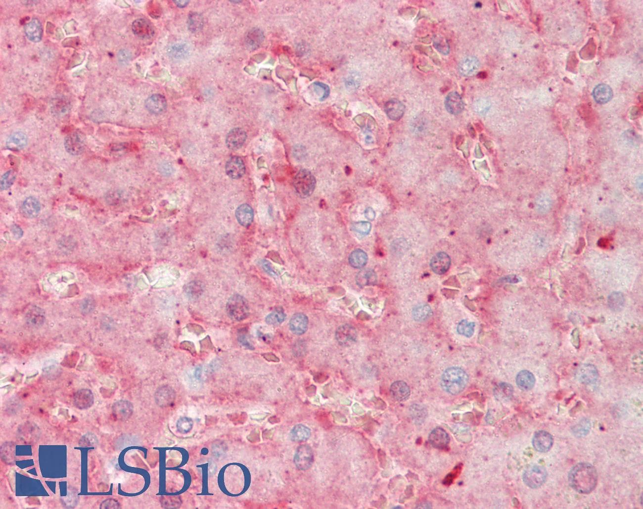 IHC-plus™ F11 / FXI / Factor XI Antibody