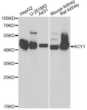 Polyclonal Rabbit anti-Human ACY1 / Aminoacylase 1 Antibody (IHC, IF, WB)