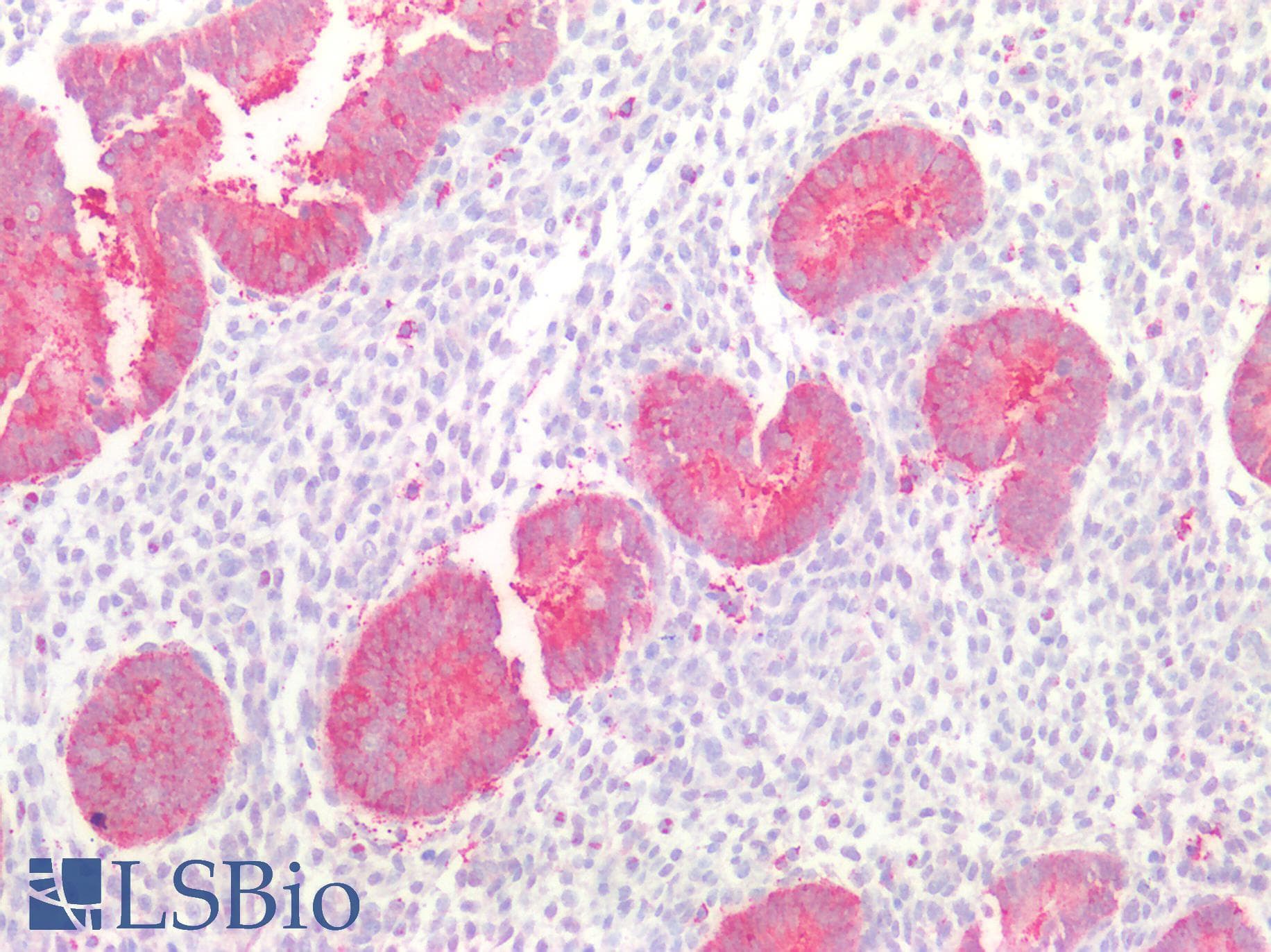 Polyclonal Rabbit anti-Human MPST Antibody (aa68-278, IHC, WB)