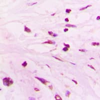 Polyclonal Rabbit anti-Human SPT3 / SUPT3H Antibody (Internal, IHC, IF, WB)