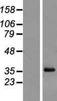 RPL6 / Ribosomal Protein L6 (Over-Expression Lysate Myc-DDK (Flag))