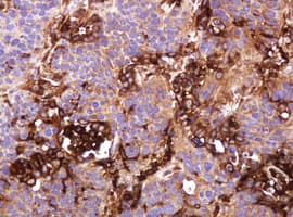 ATP6V1B2 Antibody (clone 1.00E+11, Carrier-free)
