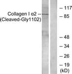 Polyclonal Rabbit anti-Human COL1A2 / Collagen I Alpha 2 Antibody (aa1053-1102, WB)