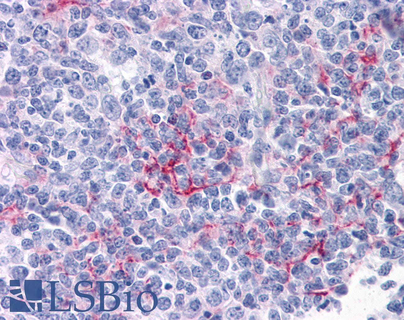 PathPlus™ FCER2 / CD23 Antibody (clone EBVCS2)