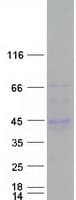 Human C6orf58 Protein (Recombinant Myc-DDK (Flag))