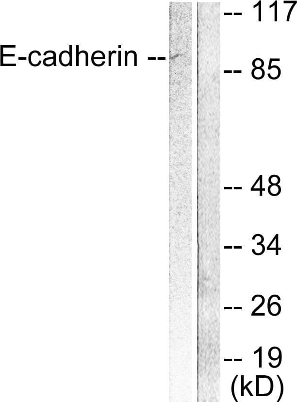 CDH1 / E Cadherin Antibody