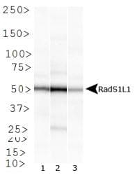RAD51B Antibody (clone 1 H3/13)