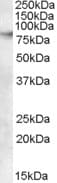 ABCB5 Antibody (aa905-916)