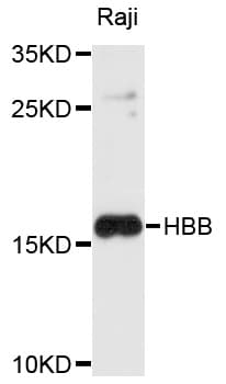 IHC-plus™ Polyclonal Rabbit anti-Human HBB / Hemoglobin Beta Antibody (IHC, WB)