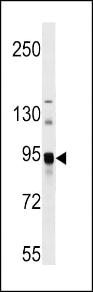 ASAH2 Antibody (aa734-762)