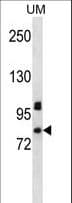 Polyclonal Rabbit anti-Human PDZD4 Antibody (aa113-141, WB)