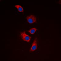 IHC-plus™ Polyclonal Rabbit anti-Human EIF4G1 / EIF4G Antibody (Internal, IHC, IF, WB)