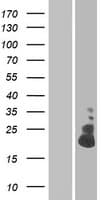 Human TMEM52B / C12orf59 Protein (Over-Expression Lysate Myc-DDK (Flag))