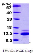 Human CTNNBIP1 / ICAT Protein (Recombinant His)