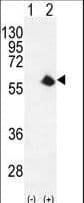 CDK8 Antibody (aa249-277)