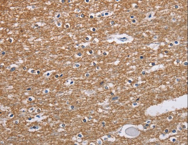 NCR2 / NKP44 Antibody