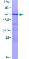 Human ANKRA2 / ANKRA Protein (Recombinant GST)