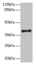 Polyclonal Rabbit anti-Human CYLC2 Antibody (WB)