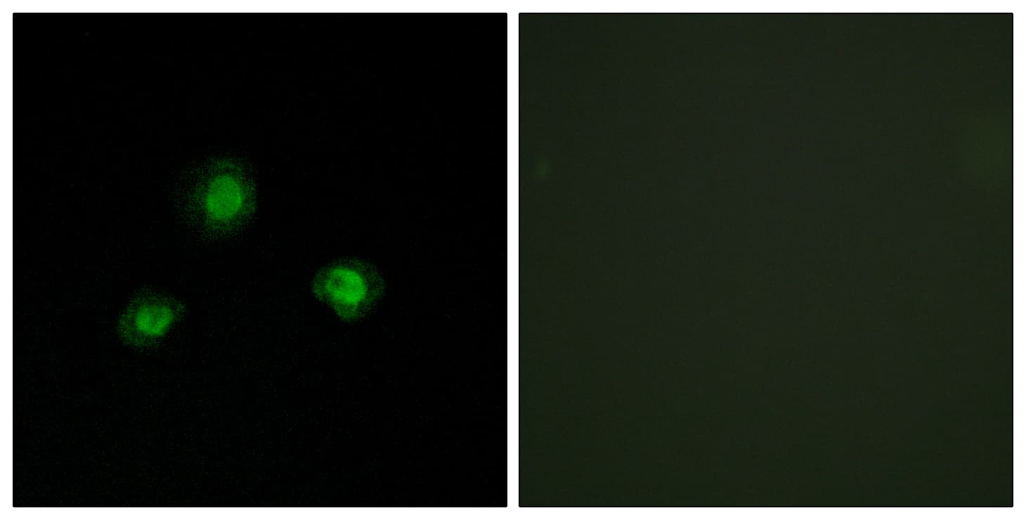 IHC-plus™ UBN1 / Ubinuclein 1 Antibody (aa161-210)