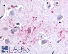 PathPlus™ Polyclonal Rabbit anti-Human ADGRB2 / BAI2 Antibody (C-Terminus, IHC)