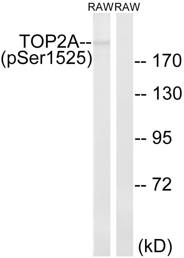 TOP2A / Topoisomerase II Alpha Antibody (phospho-Ser1525)