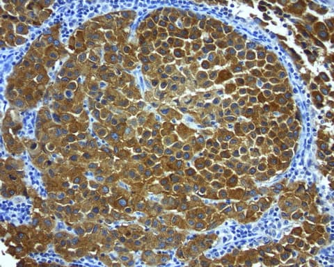 Monoclonal Mouse anti-Human MLANA / Melan-A Antibody (clone UMAB217, aa48-118, IHC, WB)