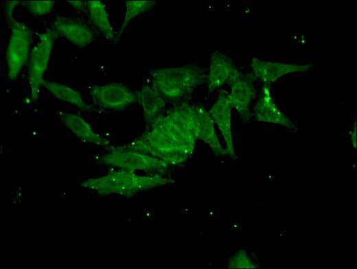 Polyclonal Rabbit anti-Human FHL5 Antibody (IF)