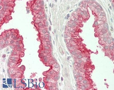 IHC-plus™ Polyclonal Rabbit anti-Human TMPRSS2 / Epitheliasin Antibody (IHC, WB)
