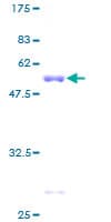 Human RHOE / RND3 Protein (Recombinant GST)